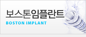 보스톤 임플란트