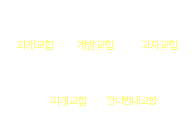 교합종류