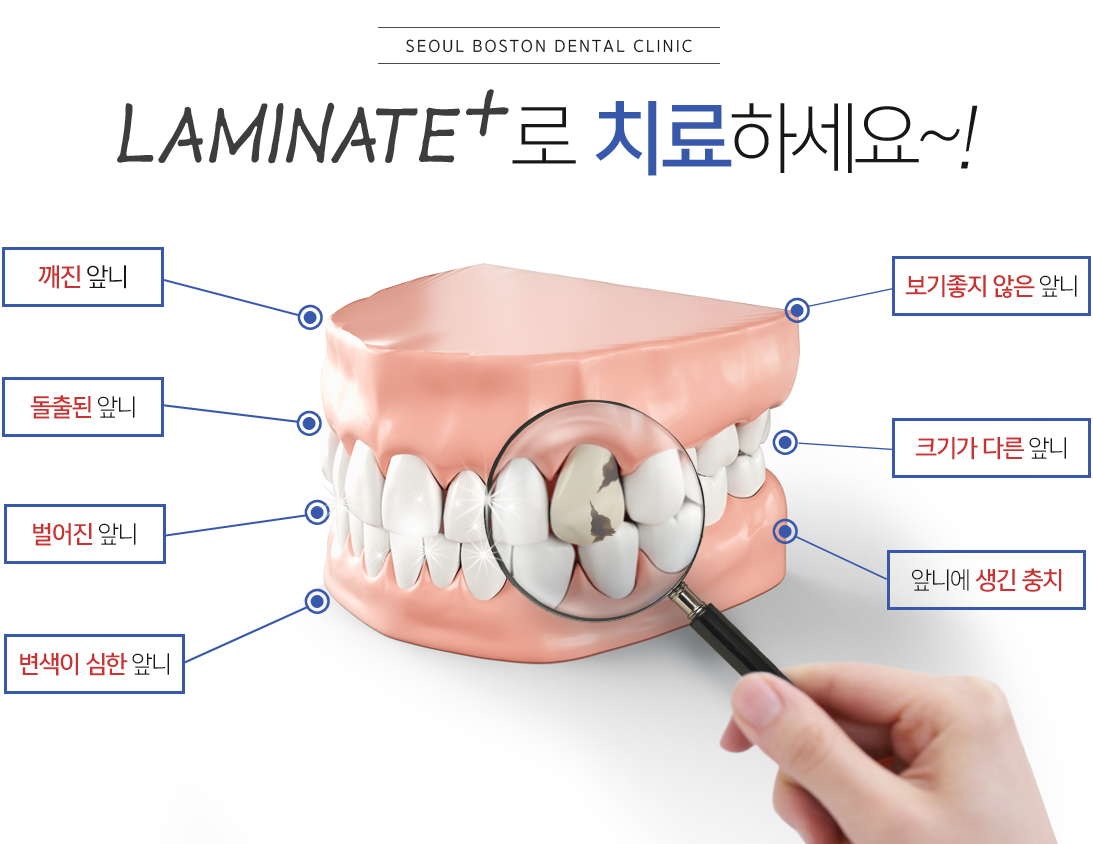 laminate+로 치료하세요~!